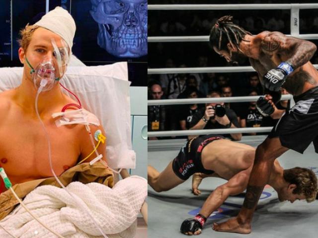Hãi hùng võ sỹ MMA: 29 giây bị hạ, 8 vết nứt xương & 9 giờ phẫu thuật