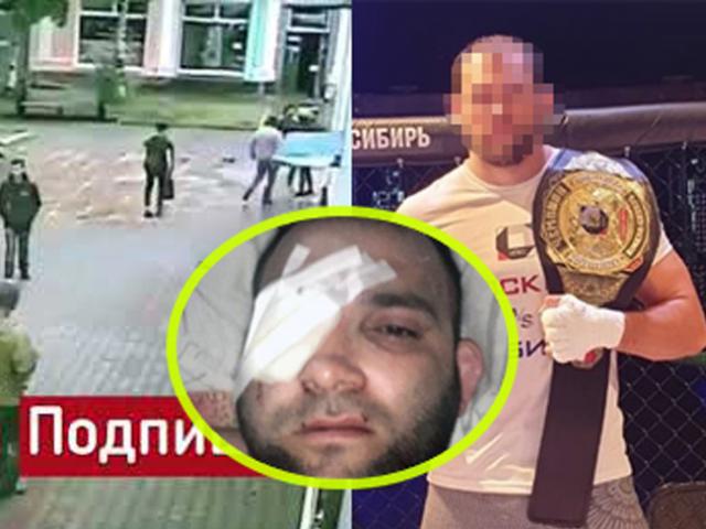 Sốc: Võ sỹ MMA mắc tội tày đình bị cảnh sát đấm ”chột” luôn 1 mắt