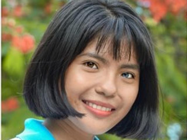 Cô gái Việt Nam xinh đẹp có đôi mắt hai màu: Căn bệnh hiếm gặp trên thế giới