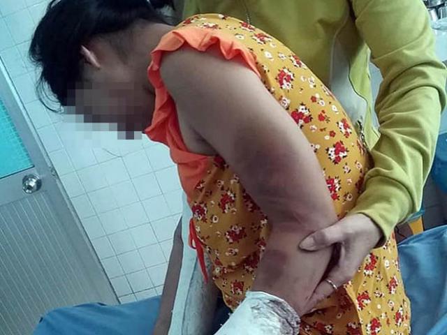 Vợ có thai bị chồng đánh gãy tay chân, vỡ nền sọ
