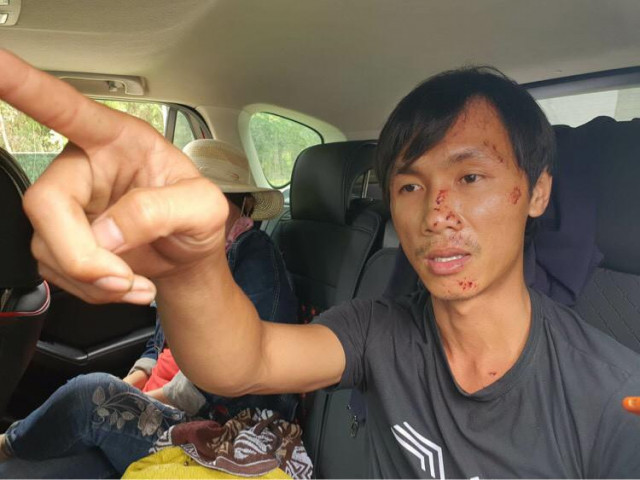 Vụ tai nạn thảm khốc ở Bình Thuận: Tài xế xe tải được đưa ra Nha Trang chụp chân