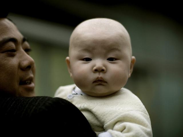 ”Mốt” mới ở TQ: Cha mẹ đua nhau dùng ”thiết bị thần kỳ” nắn đầu con mới sinh