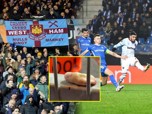 Kinh hoàng fan West Ham đứt lìa ngón tay trong lúc ăn mừng bàn thắng