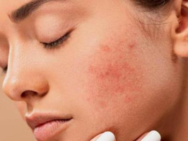 5 yếu tố ảnh hưởng xấu đến làn da của bạn