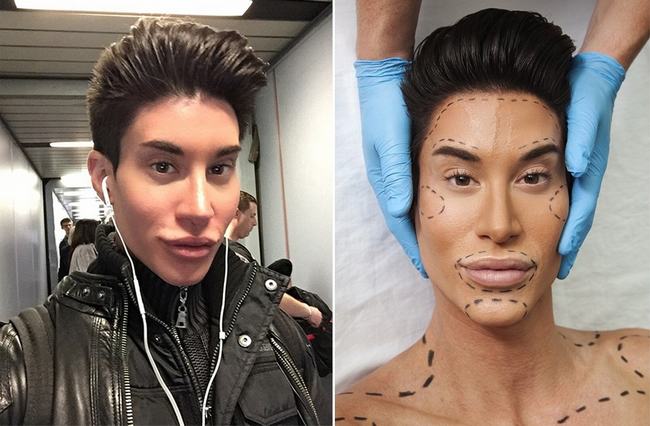 Justin Jedlica 34 tuổi đến từ New York cũng có niềm đam mê kỳ lạ với búp bê Ken. Anh chàng này đã phải trải qua đến hơn 190 ca phẫu thuật để có cơ thẻ mà anh cho là hoàn hảo nhất.