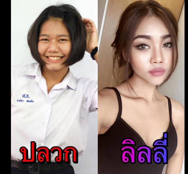 Naika Nayika nổi tiếng sau khi đăng những hình ảnh trước khi phẫu thuật thẩm mỹ của mình. Sự khác biệt đến ngỡ ngàng về&nbsp;cơ thể trước và sau &#34;dao kéo&#34; của cô khiến không ít người&nbsp;bất ngờ.