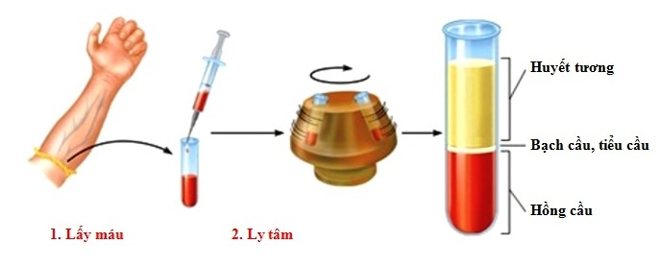 MC Quỳnh Chi “phát cuồng” vì công nghệ nâng mũi S line Plus - 4