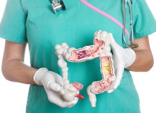 Từ viêm đại tràng tới ung thư đại trực tràng rất gần - 1