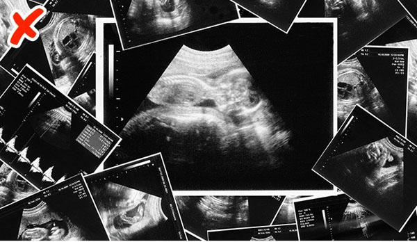 13 quan niệm sai lầm khi mang bầu ai cũng tin “sái cổ” - 11