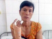 Pháp luật - Đánh hàng xóm, thư ký tòa bị tù treo