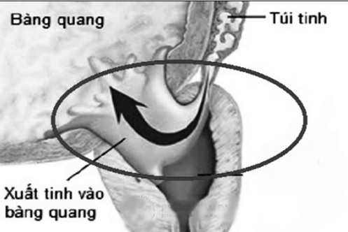 Cách giữ “lửa yêu” ở người đái tháo đường - 2