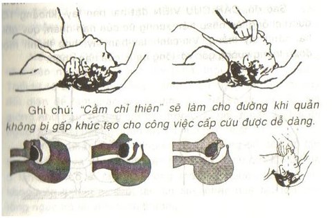 Cháy chung cư 13 người chết: Làm sao thoát hiểm và tránh ngạt khói? - 3