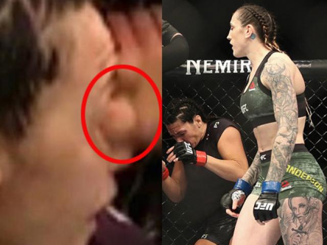 Knock-out MMA kinh sợ: Ngón chân mỹ nữ găm thẳng vào đối thủ