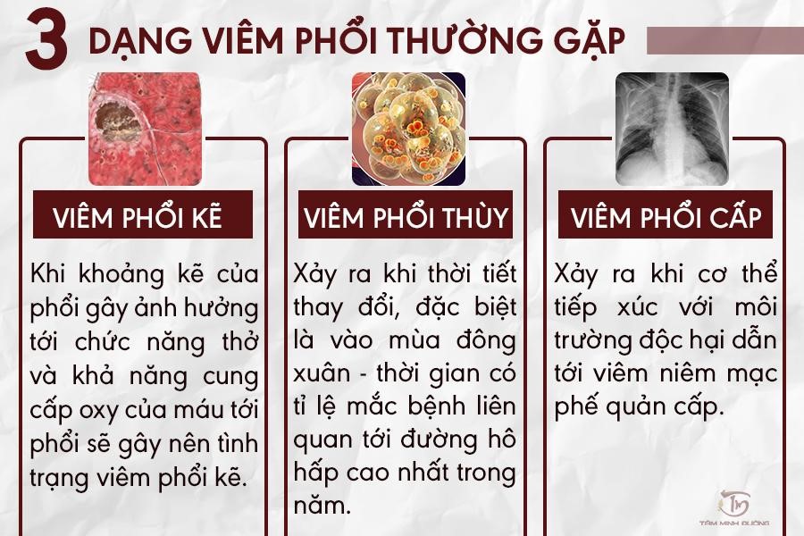 Viêm phổi là gì? Nguyên nhân, triệu chứng và lộ trình điều trị dứt điểm - 2