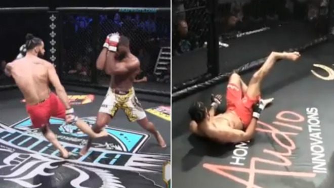 Võ sĩ MMA tung cước vào đầu gối, chân biến dạng đáng sợ - 1
