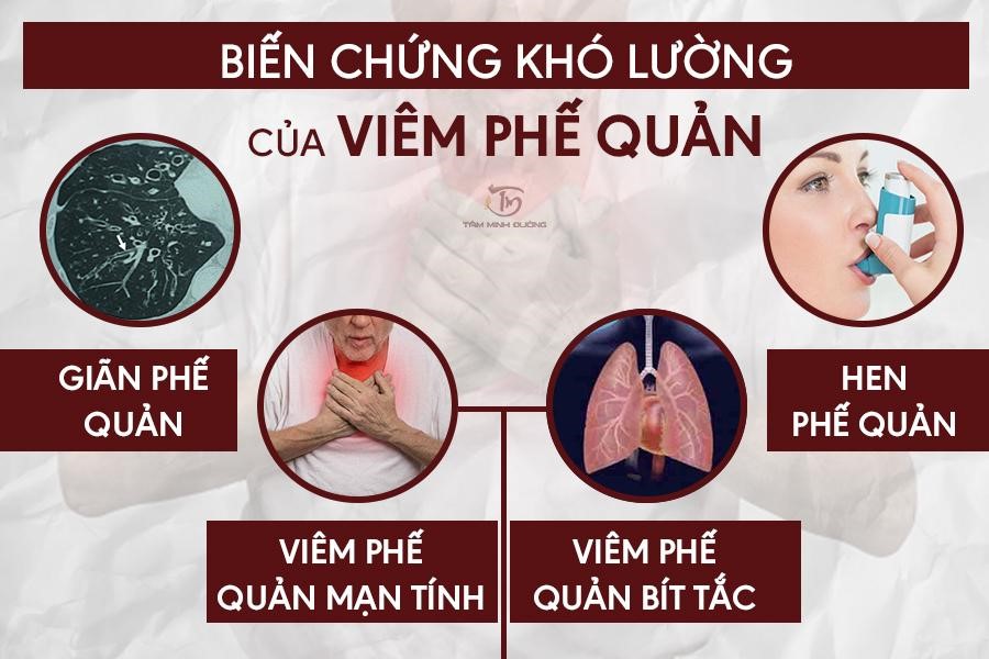 Viêm phế quản là gì? Nguyên nhân, triệu chứng và cách chữa bệnh hiệu quả tại nhà - 3