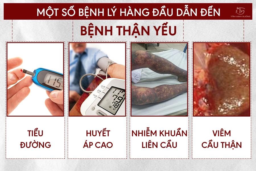 Thận yếu là gì? Nguyên nhân, triệu chứng và cách chữa bệnh bằng thuốc Đông Y - 2