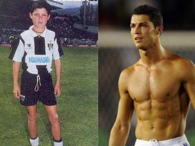 Ronaldo bị bóc mẽ: “Vịt hóa thiên nga” nhờ phẫu thuật thẩm mỹ