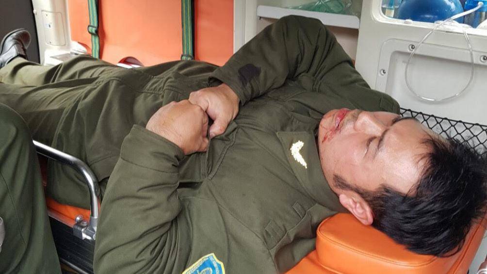 Đang giám định thương tật nhân viên an ninh Nội Bài bị hành hung - 1