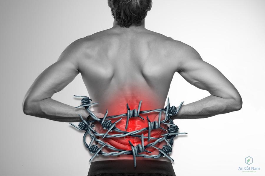 Gai cột sống lưng và cách điều trị bằng thuốc nam hiệu quả tuyệt đối - 1
