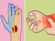 Sức khỏe đời sống - Khi thấy tay hoặc chân thường xuyên bị tê, hãy dè chừng những bệnh nguy hiểm sau