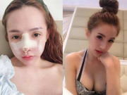 Làm đẹp - Đẹp như tiên, hot girl thẩm mỹ Sài Gòn tiếp tục sửa mũi bất chấp nguy hiểm