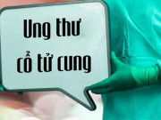 Sức khỏe đời sống - Bác sĩ Bệnh viện K cảnh báo dấu hiệu ung thư cổ tử cung nhất định chị em phải biết