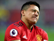 Bóng đá - MU đấu PSG Cúp C1: Hàng công tàn tạ vì Sanchez, Solskjaer muốn ghi mấy bàn?