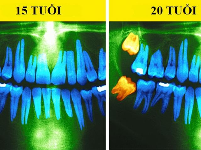 Những thay đổi không thể cưỡng lại của cơ thể sau mỗi 10 năm dù bạn có “đốt” tiền cho thần dược