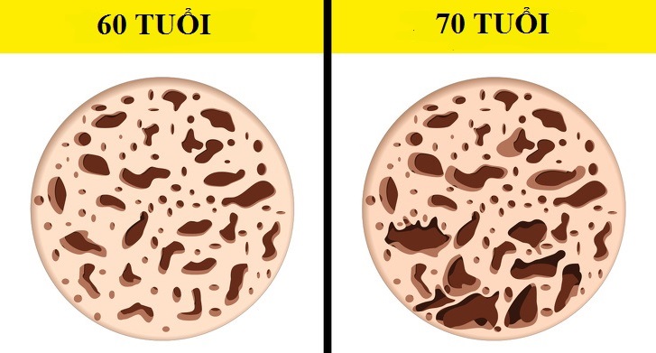 Những thay đổi không thể cưỡng lại của cơ thể sau mỗi 10 năm dù bạn có “đốt” tiền cho thần dược - 5