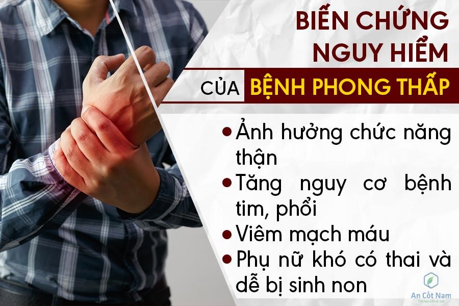 Bệnh phong thấp: Nguyên nhân, triệu chứng và cách điều trị phong tê thấp - 2