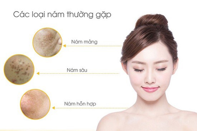 Giải mã bí mật của viên uống làm mờ nám đang được chị em “săn lùng” - 1