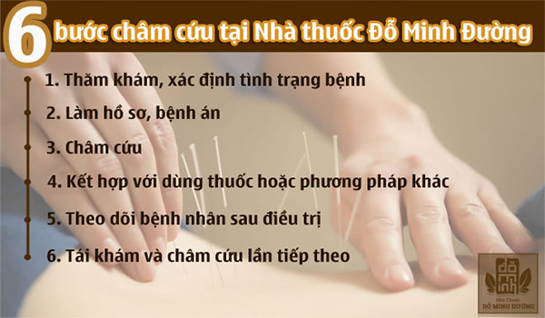 Châm cứu là gì? Tác dụng của châm cứu chữa bệnh không thể bỏ qua - 3