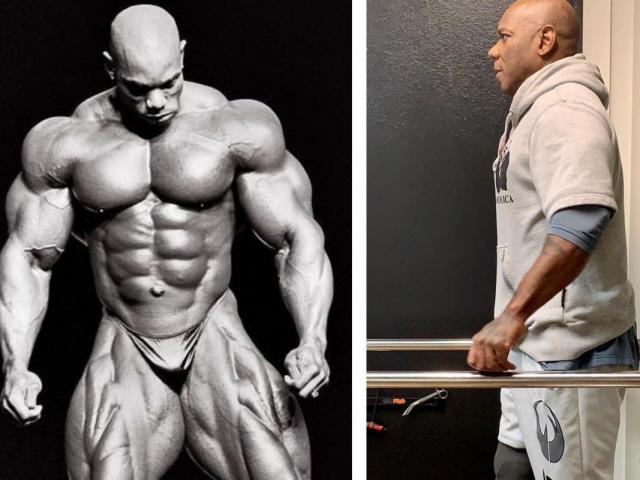 Flex đã phải cắt bỏ phần chân phải vào năm 2019