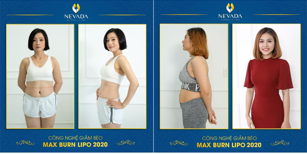 NSUT Mỹ Duyên và diễn viên Vân Trang giảm cân thành công với Max Burn Lipo