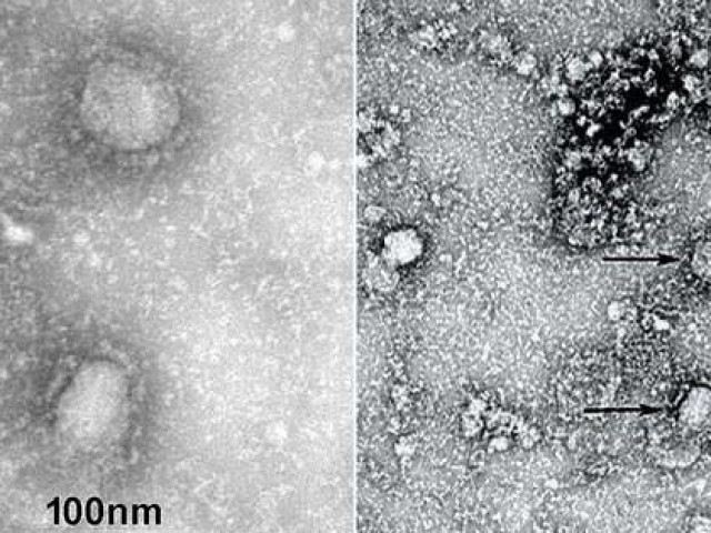 Trung Quốc công bố những hình ảnh đầu tiên của virus Vũ Hán