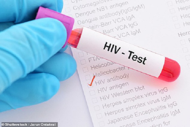 HIV/AIDS được coi là căn bệnh thế kỷ mà đến nay vẫn chưa có thuốc đặc trị. Ảnh: SHUTTERSTOCK.