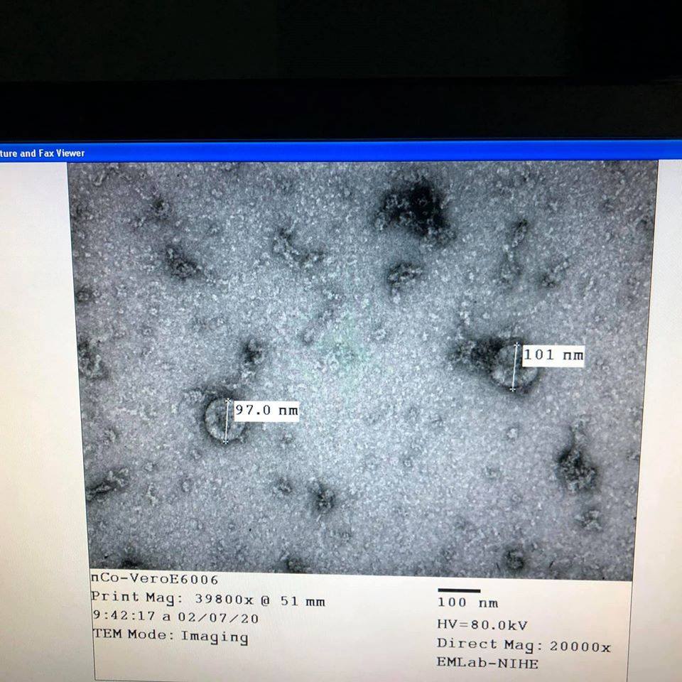 Hình ảnh phân lập virus Corona được Viện Vệ sinh Dịch tễ Trung ương nghiên cứu thành công.