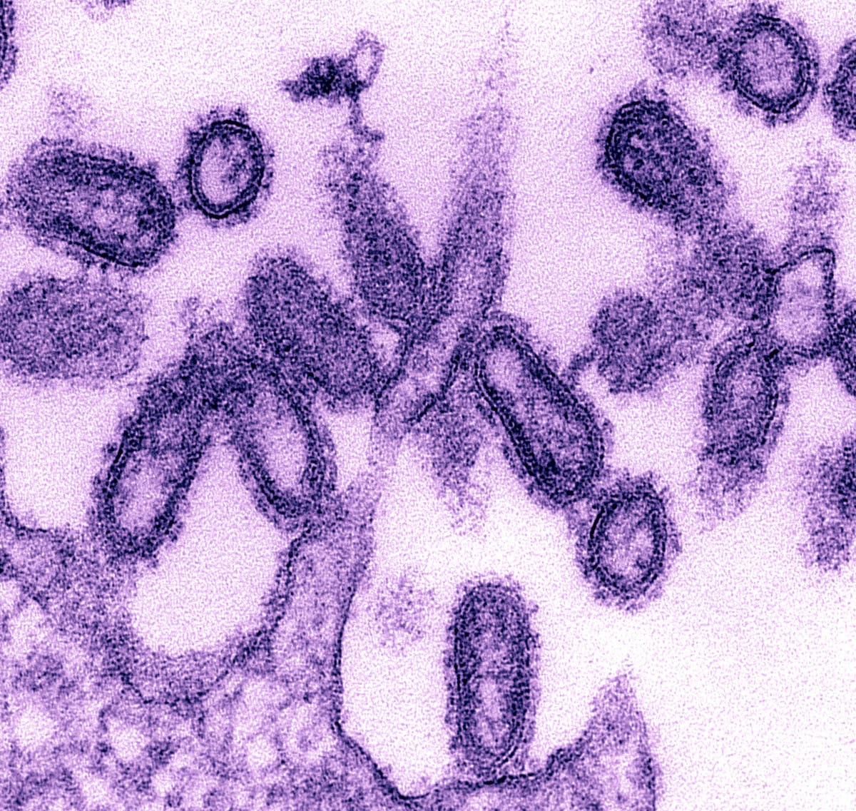 Hình ảnh virus cúm A (H1N1). Ảnh: Getty