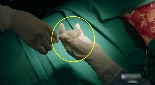 Lỗi dễ nhận thấy ở khâu lựa chọn găng tay y tế khi phẫu thuật quá rộng.
