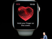 Công nghệ thông tin - Apple “bắt tay” với Johnson &amp; Johnson để giúp Apple Watch ngăn chứng đột quỵ