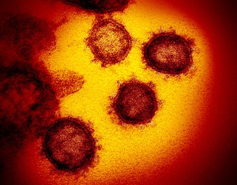 Ảnh qua kính hiển vi của virus SARS-CoV-2 gây dịch Covid 19