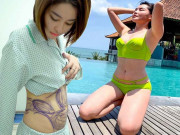 Làm đẹp - Hot girl Trâm Anh, Thúy Vi... béo sau hút mỡ, uổng phí trăm triệu do đâu?