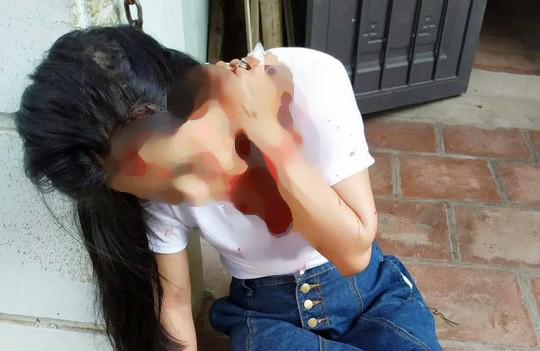Hình ảnh chị Nguyễn Thị H. máu me đầy người sau khi bị "chồng hờ" của mẹ đâm trọng thương