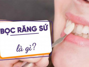 Làm đẹp - Bọc răng sứ là gì ? Bọc răng sứ có tốt không và đẹp vĩnh viễn như quảng cáo?