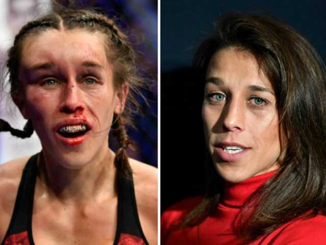 Joanna Jedrzejczyk biến dạng mặt sau một trận đấu