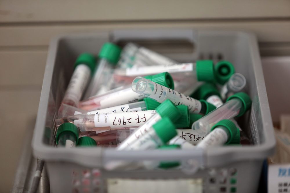 Các mẫu bệnh phẩm Covid-19 tại một bệnh viện ở Vũ Hán (ảnh: Bloomberg)