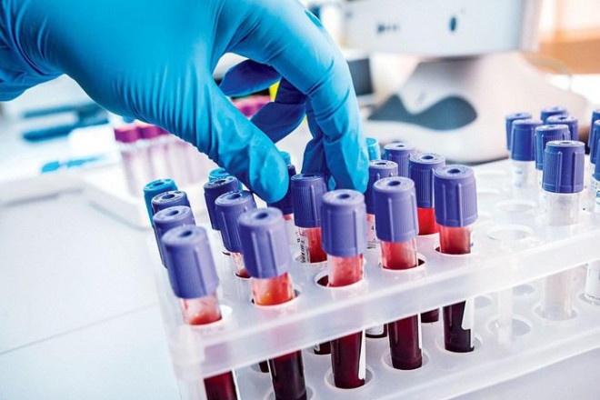 Xét nghiệm máu mới có thể giúp phát hiện ung thư cực kỳ hiệu quả - ảnh minh họa từ AMERICAN CHEMICAL SOCIETY