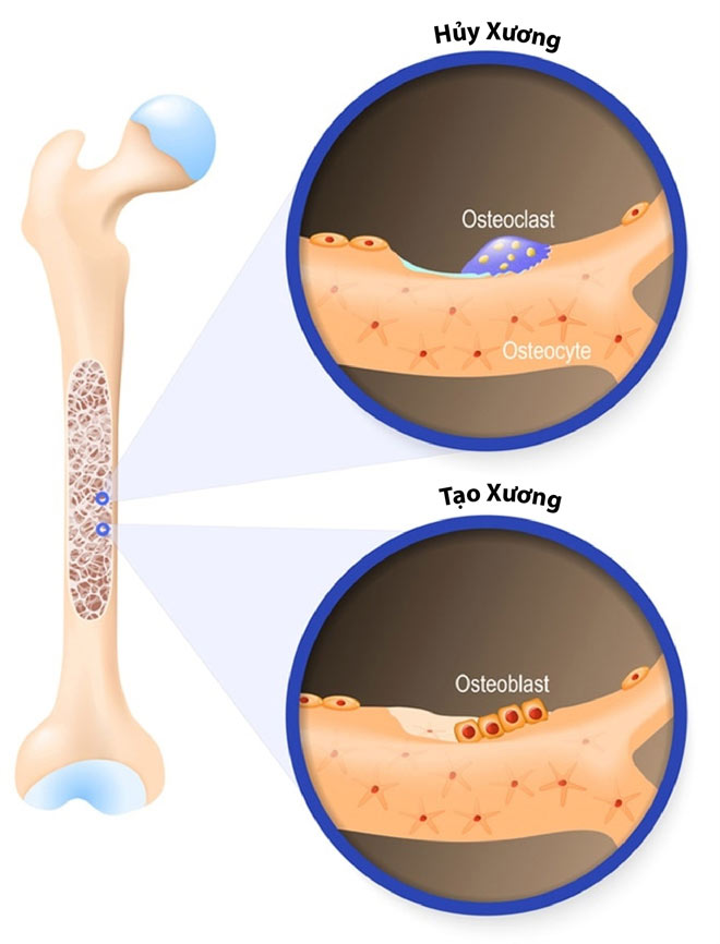 Trong xương luôn diễn ra 2 quá trình: tạo xương và hủy xương