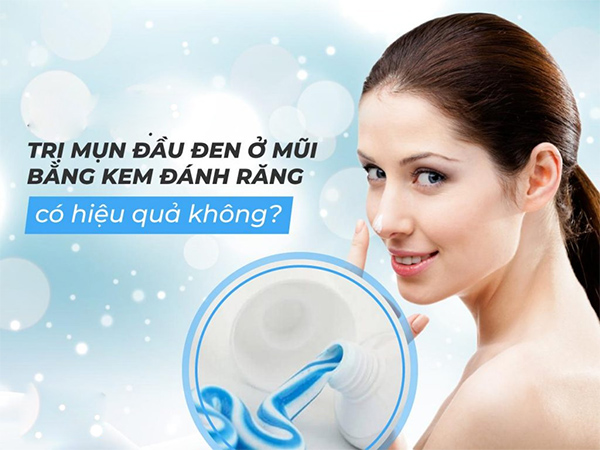 10 cách trị mụn đầu đen ở mũi tận gốc tại nhà an toàn và hiệu quả nhất - 2